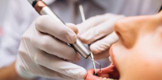 Claves en la prevención, detección y el manejo de las caries interdentales en la actualidad caries-interdentales