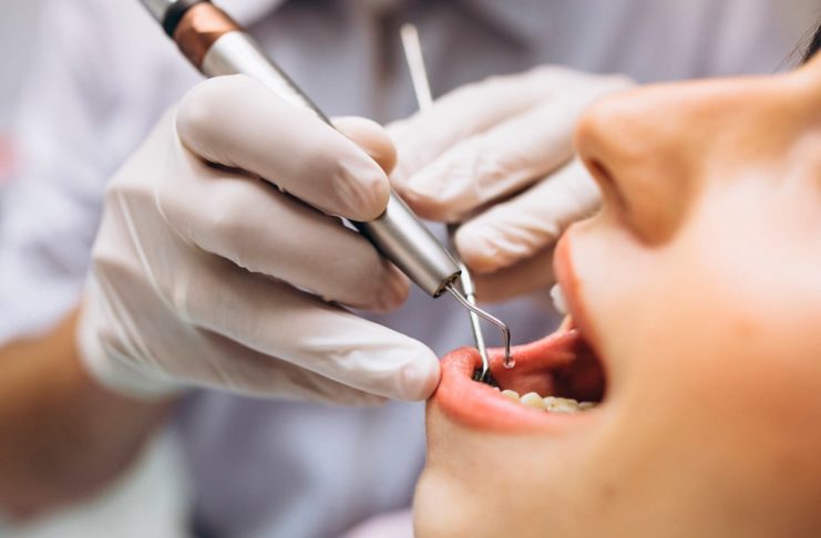 Claves en la prevención, detección y el manejo de las caries interdentales en la actualidad caries-interdentales